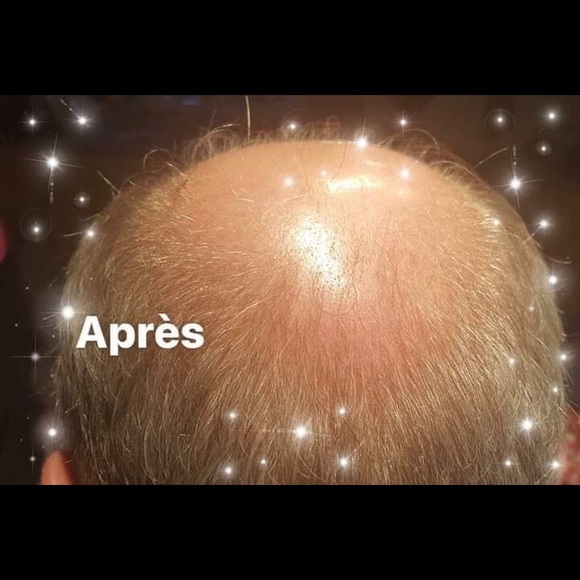 Sorduse huile capillaire pour cheveux - Picture 4 of 6